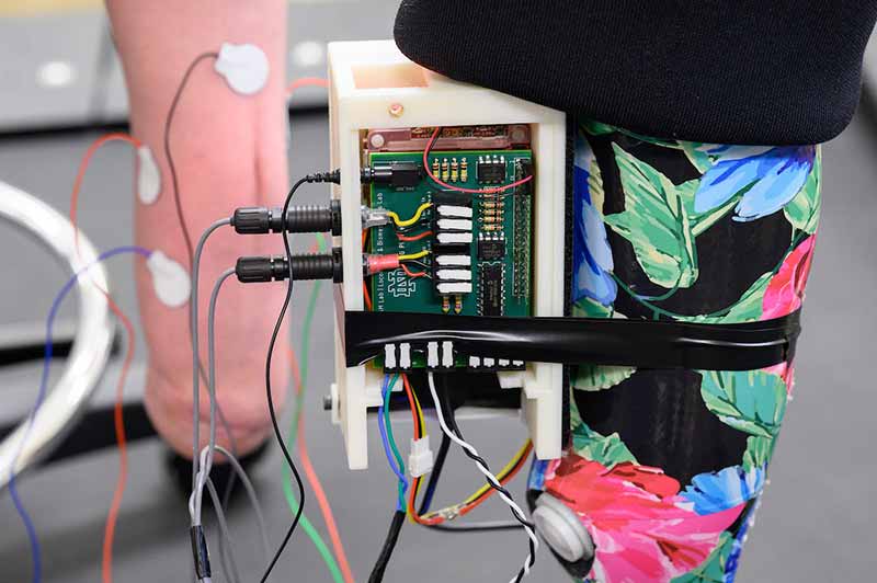 Detail of sensors on a amputated leg	connect to a powered prosthetic lower-leg.